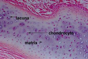 <p>most abundant type of cartilage; short and dispersed collagen fibers</p><ul><li><p>forms <strong>moveable joints</strong> and embryonic skeleton</p></li><li><p>found on the <strong>ends of long bones</strong>, ribs and nose</p></li></ul><p></p>