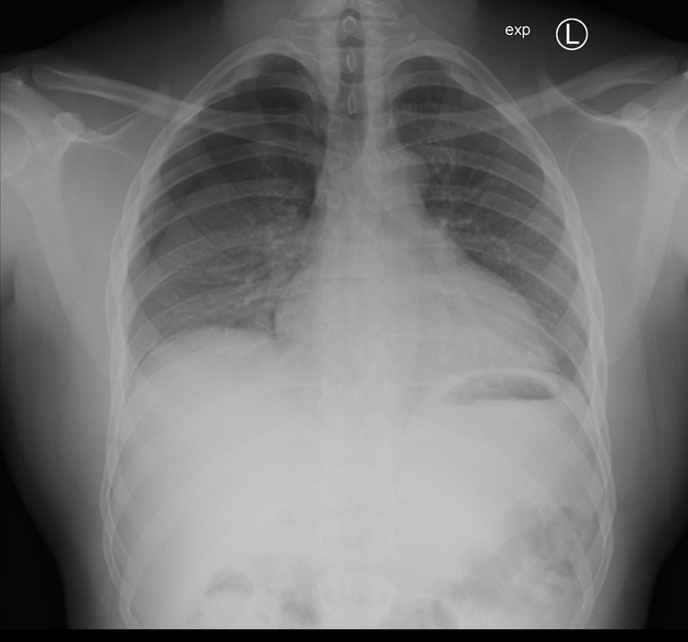 <p>Describe the abnormality demonstrated. </p>