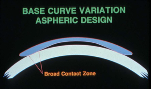 <p>IMPORTANT: When would you consider using an aspheric back surface on a corneal, single vision, GP lens and why?</p>