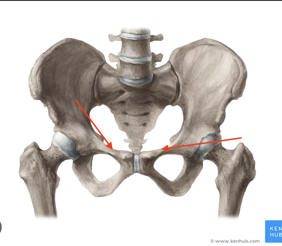 <p>upper bridge over the obturator foramen </p>
