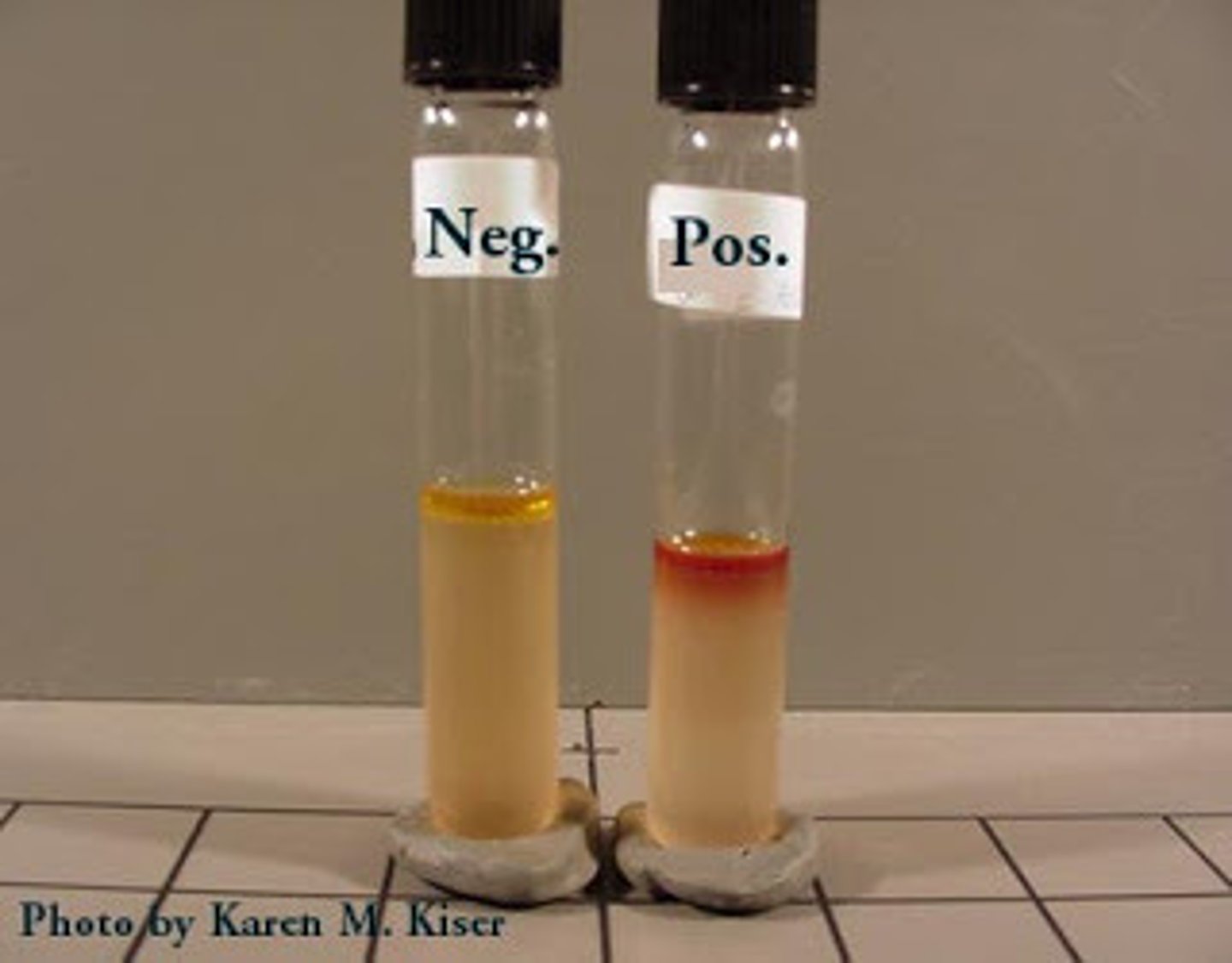 <p>Tryptophanase</p>