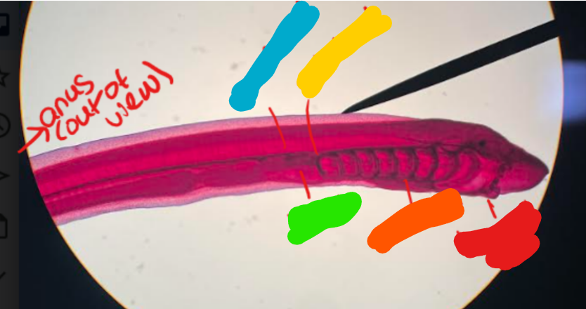 <p>What animal is this? What Phylum/Subphylum is it part of? Identify the labeled structures. </p>