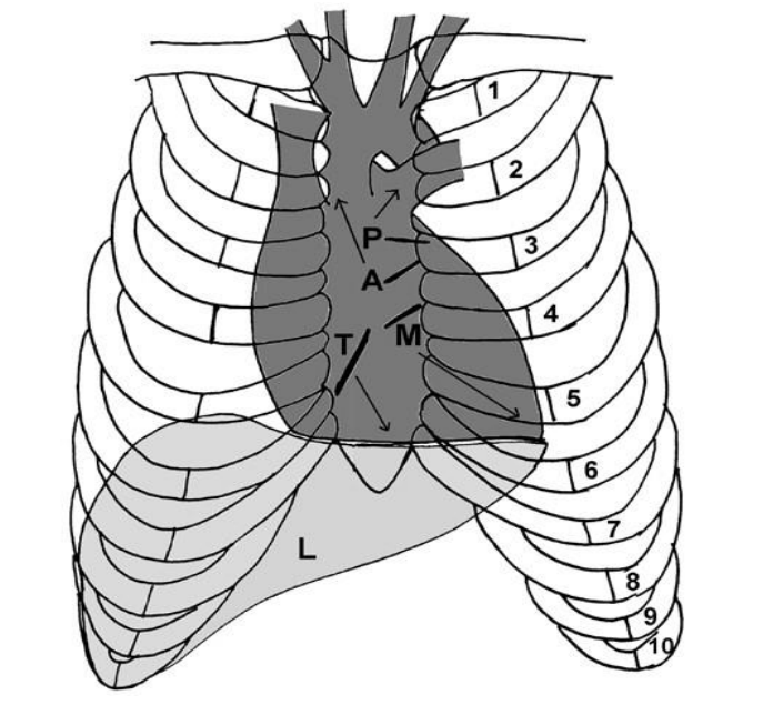 <p>vertical line of valves (superior to inferior) → “PAMT”</p><p>right: 3 - 6 costal cartilages</p><p>left: 2nd costal cartilage → 5th intercostal space</p><p></p><p>auscultation points:</p><p>Pulmonary valve → 2nd and 3rd left intercostal spaces </p><p>Aortic valve → 2nd right intercostal space radiating up to the neck </p><p>Mitral valve → apex, 5th intercostal space, mid-clavicular line </p><p>Tricuspid valve → lower left sternal edge, may also be heard on the right</p><p></p>