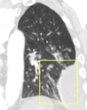 <p>Name the pathology </p>