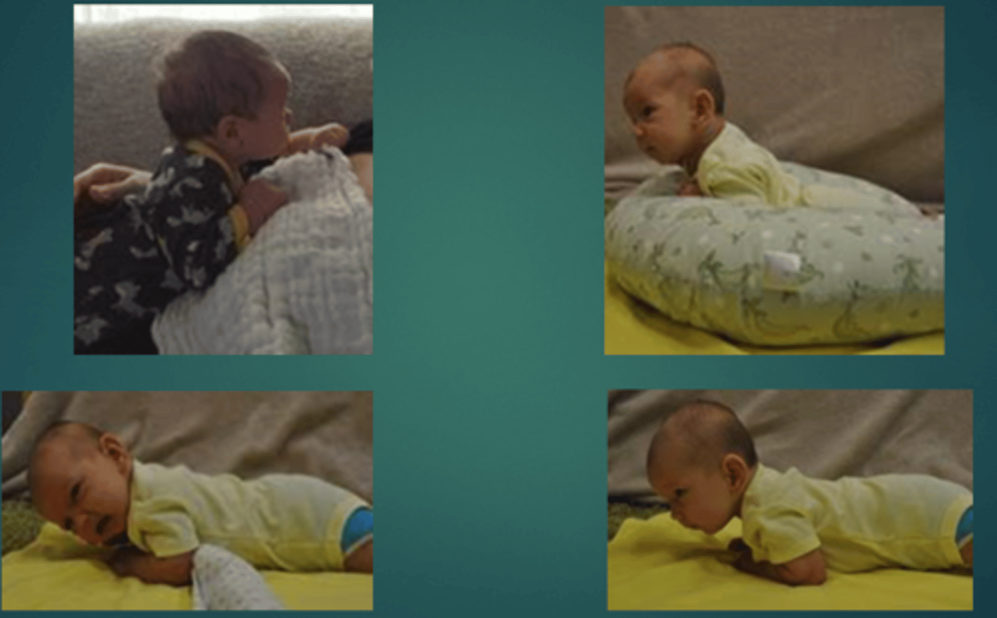 <p>-45 deg head lift</p><p>-head lags on pull to sit</p><p>-smiles</p><p>-begins prone on elbows with elbows behind shoulders</p><p>-head bob in supported sitting</p>