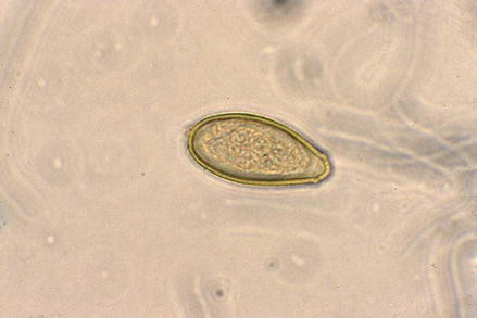 <p>in human or dog/cat/carnivore stool</p><p>fibrosis, gall bladder inflammation, pancreatitis</p><p>history of eating raw freshwater fish</p><p>East Asia, East Russia, Indian Subcontinent, Pacific Asia</p>