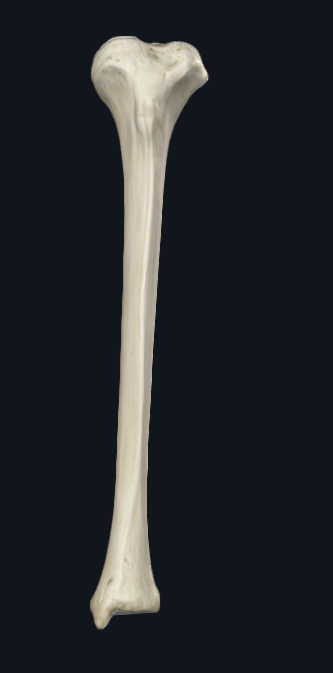 <p>What bone is this</p>