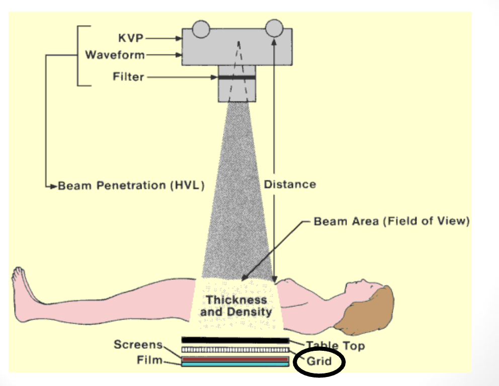 <p><strong>What is the <u>objective</u> of using Grids in radiography?</strong></p>