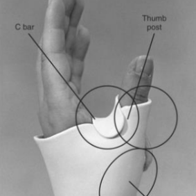 <p>Name this static splint component. What’s its function?</p>