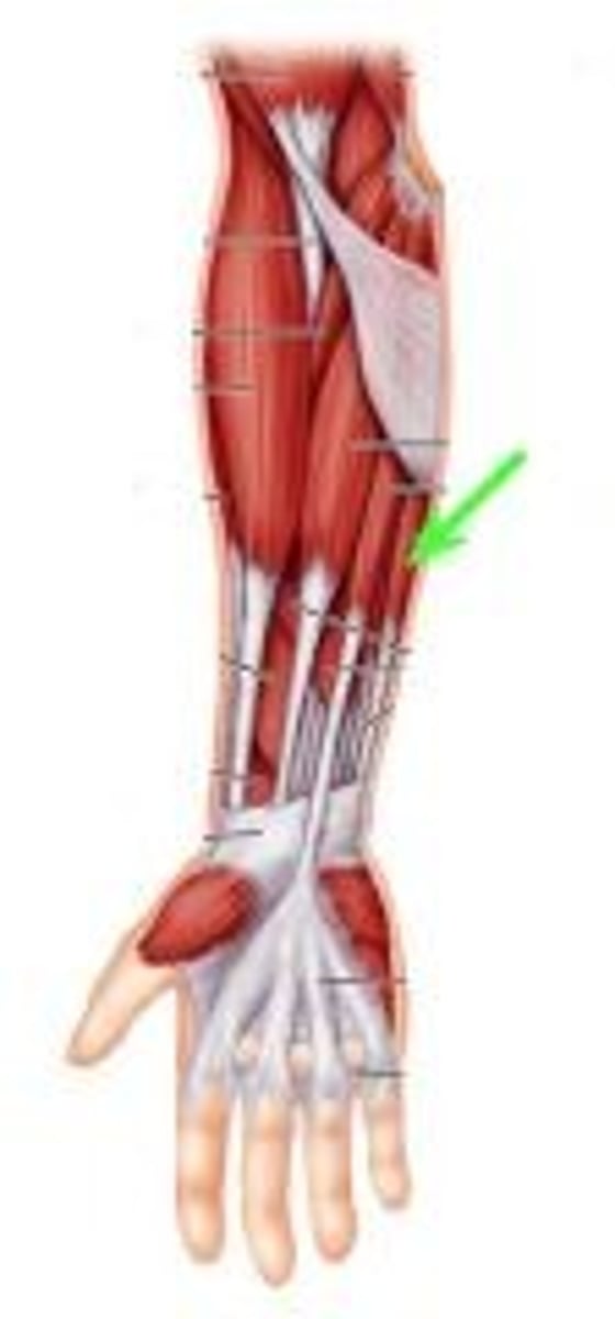 <p>Origin: Medial epicondyle of humerus</p><p>Insertion: Base of metacarpal 5</p><p>Action: Flex wrist and abduct hand</p>