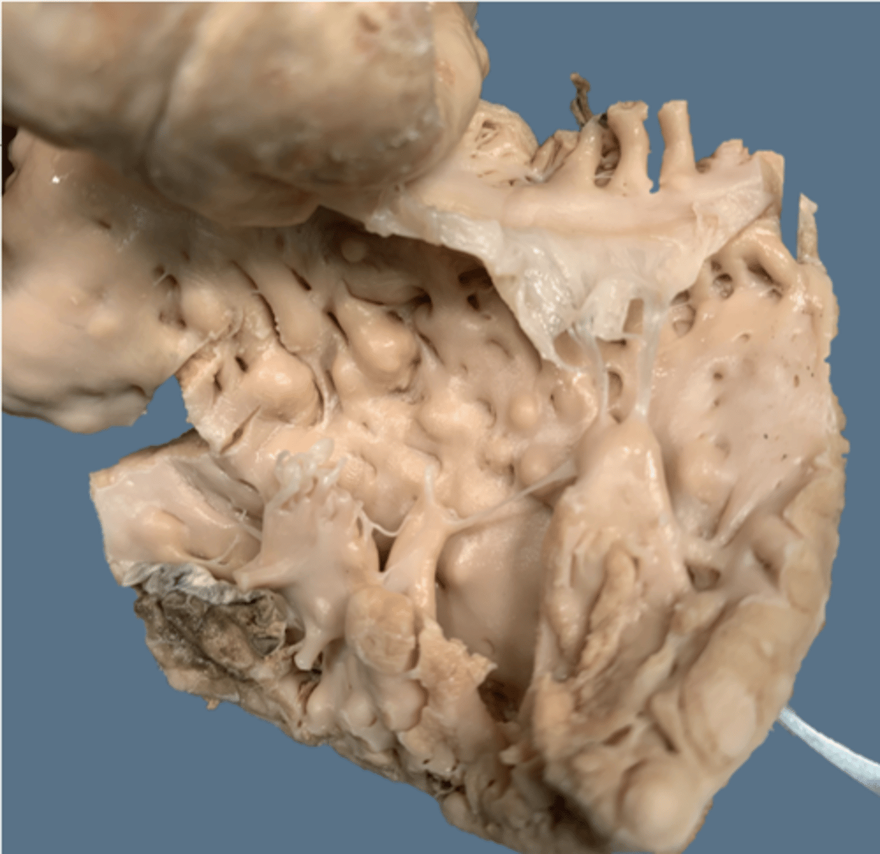 <p>Where are the nodules embedded?</p>