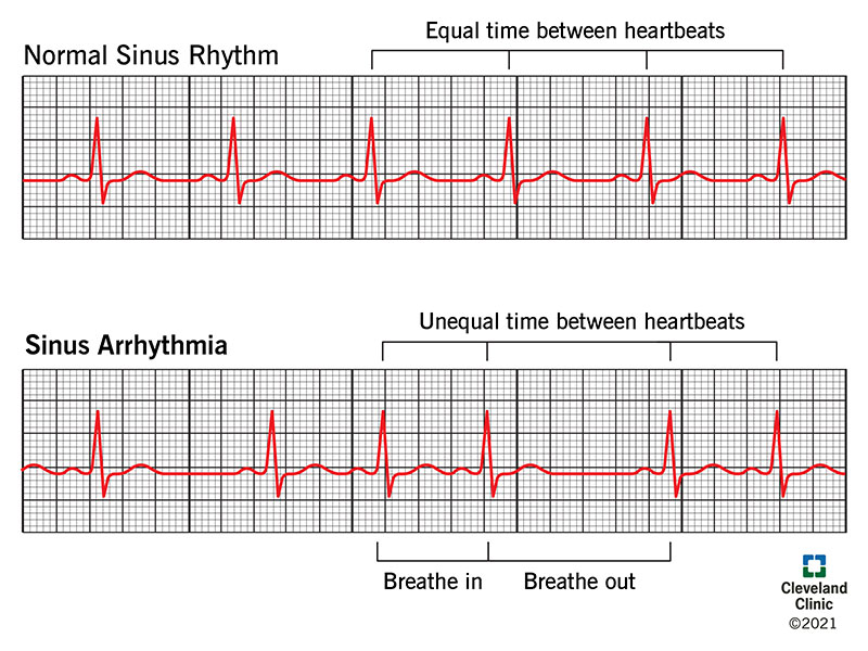 <p>The SA node. it establishes normal cardiac rhythm known as <strong>sinus rhythm</strong>. Note that in sinus rhythm, beats per minute must be 60-100bpm with no skipped, early, or late beats.</p>