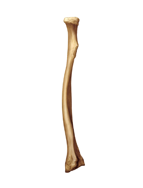 <p>What bone is this?</p>