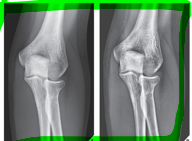 <p>Post-processing edge enhancement helps to </p>