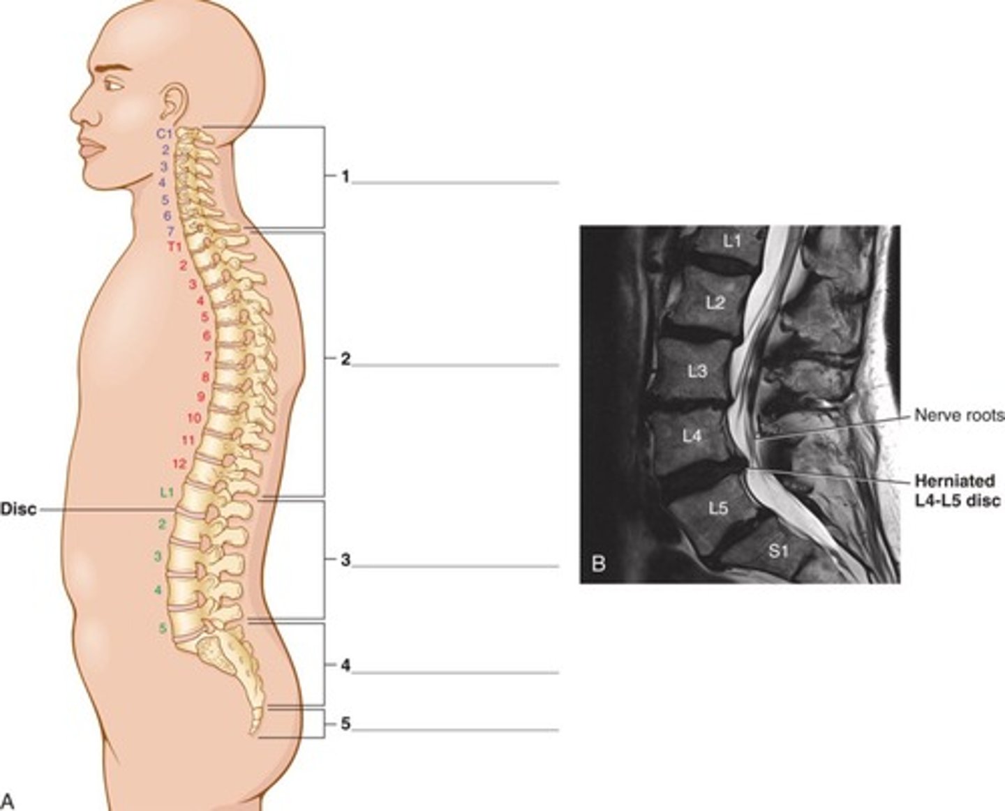 <p>Cervical, thoracic, lumbar, sacral, coccygeal.</p>