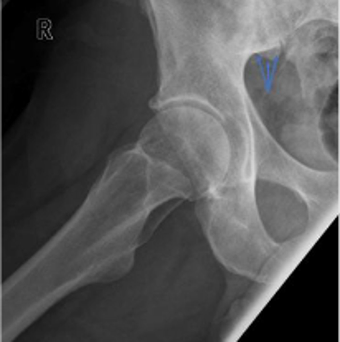 <p>What are the arrows pointing to?</p>