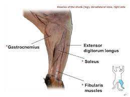 <p>Origin: Lateral and medial condyles of the femur</p><p>Insertion: By the Achilles tendon on the calcaneus</p><p>Action: Extends foot</p>