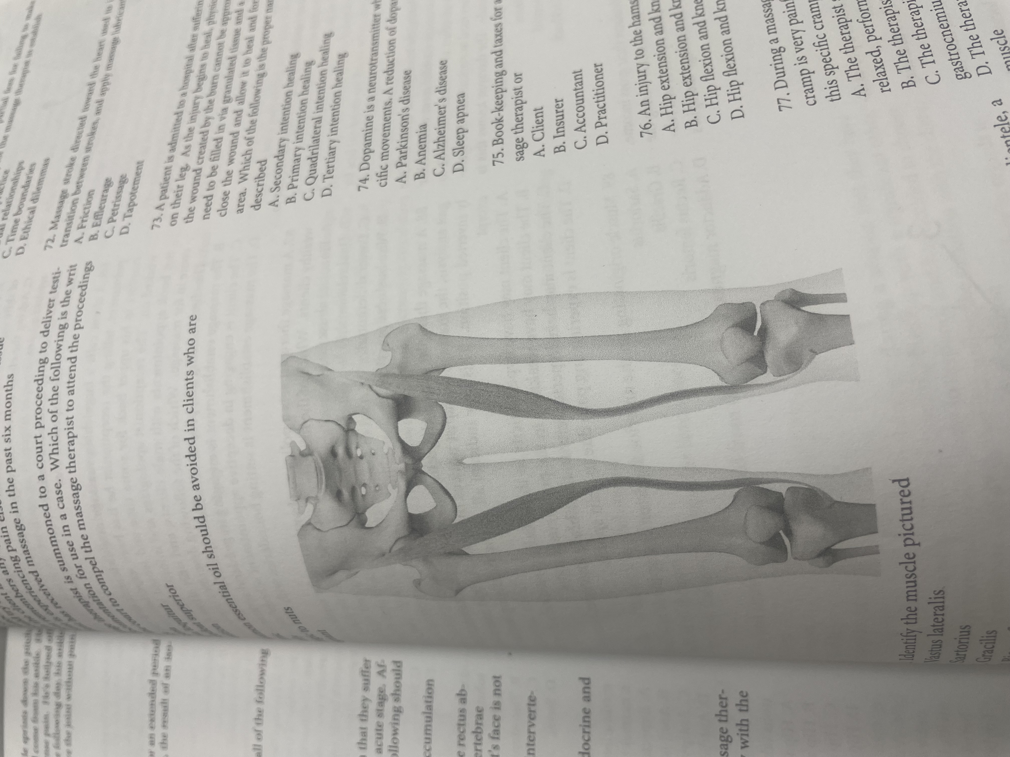 <p>Indentify the muscle pictured</p>