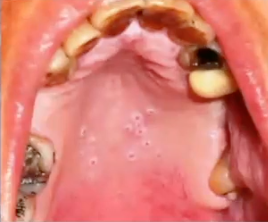 <p>what is the diagnosis </p>