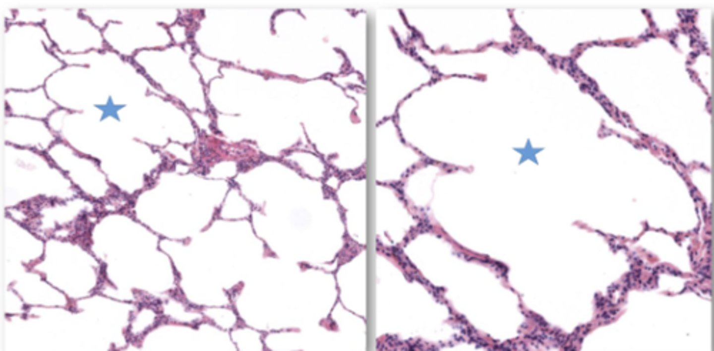 <p>Identify the starred portion of the airway</p>