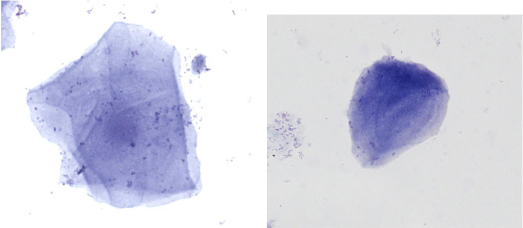 <p>“Cornflakes” utan kärna</p>