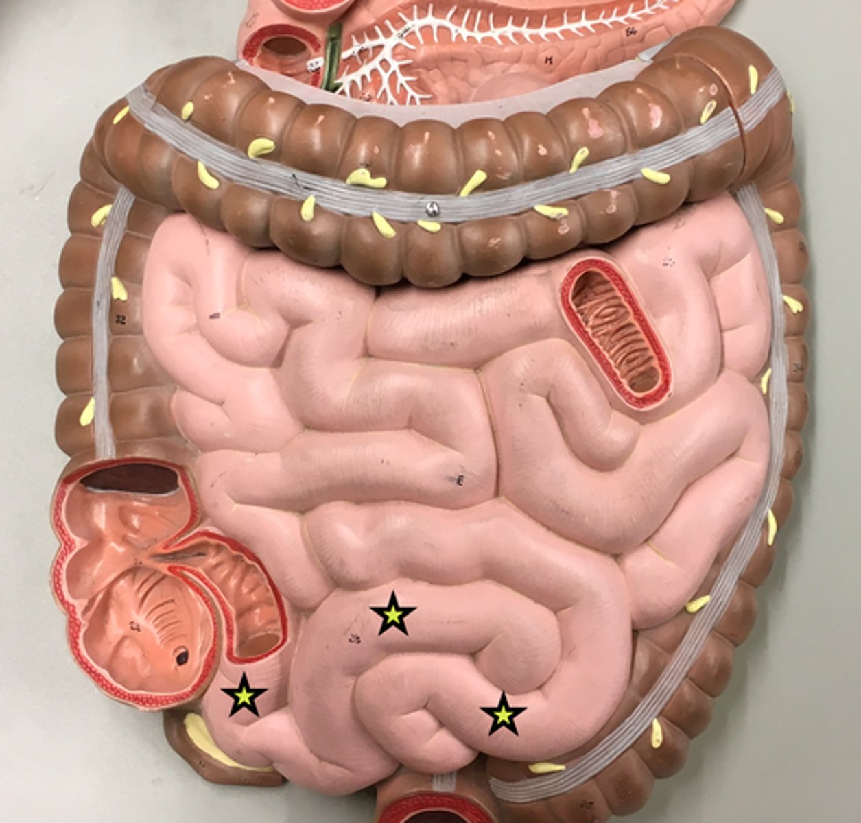 knowt flashcard image