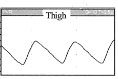 <ol><li><p>Flattened or rounded systolic peak</p></li><li><p>Equal upslope and down slope time</p></li><li><p>Absent dicrotic notch or reflected wave</p></li><li><p>Decrease in amplitude</p></li><li><p><strong>DISEASE REFLECTED PROXIMAL</strong></p></li></ol><p></p>