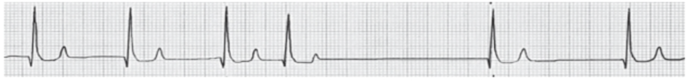 <p><span>Name, reading summary, and significance of this rhythm:</span></p>