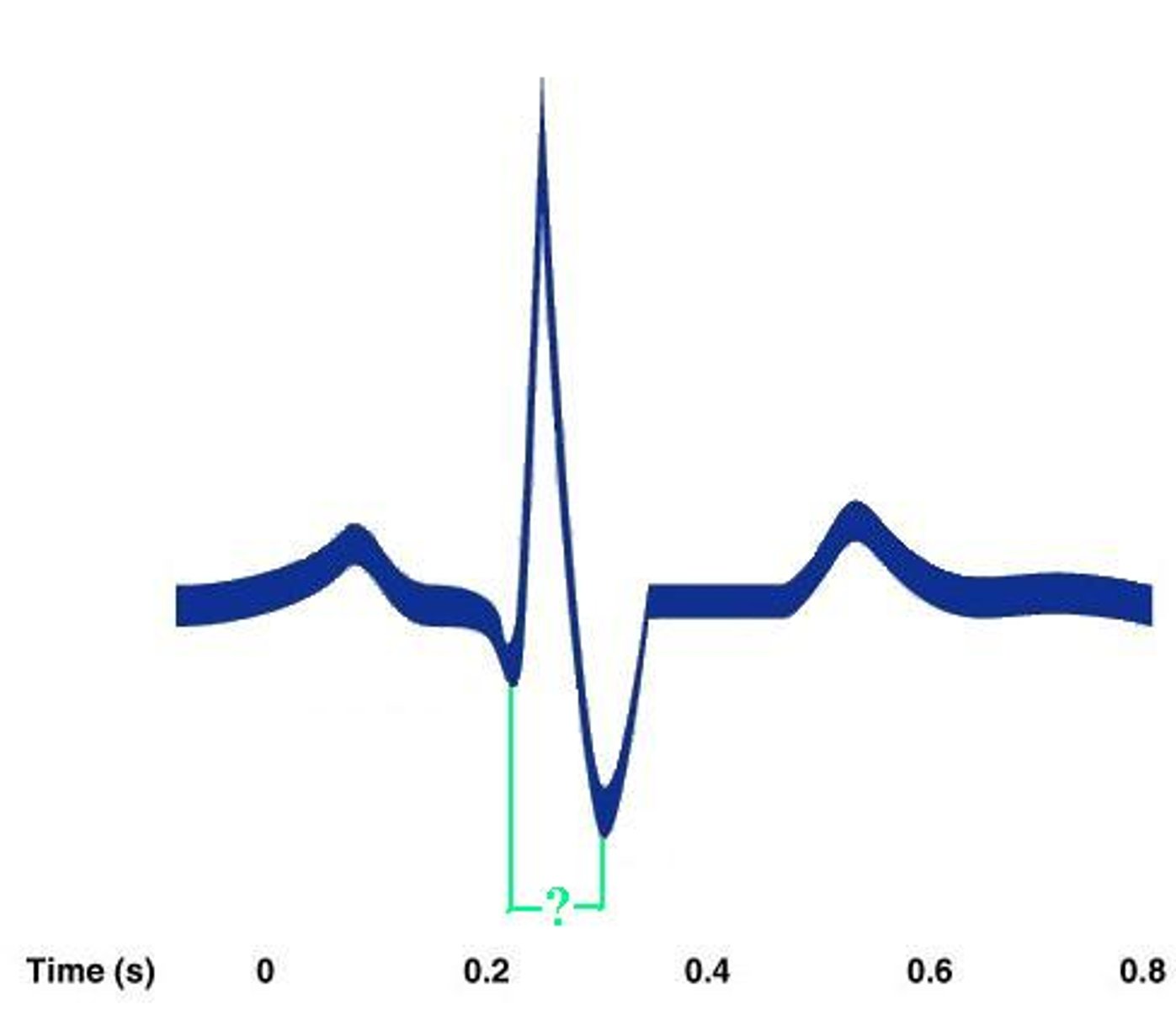 <p>Identify the indicated portion of the EKG.</p>