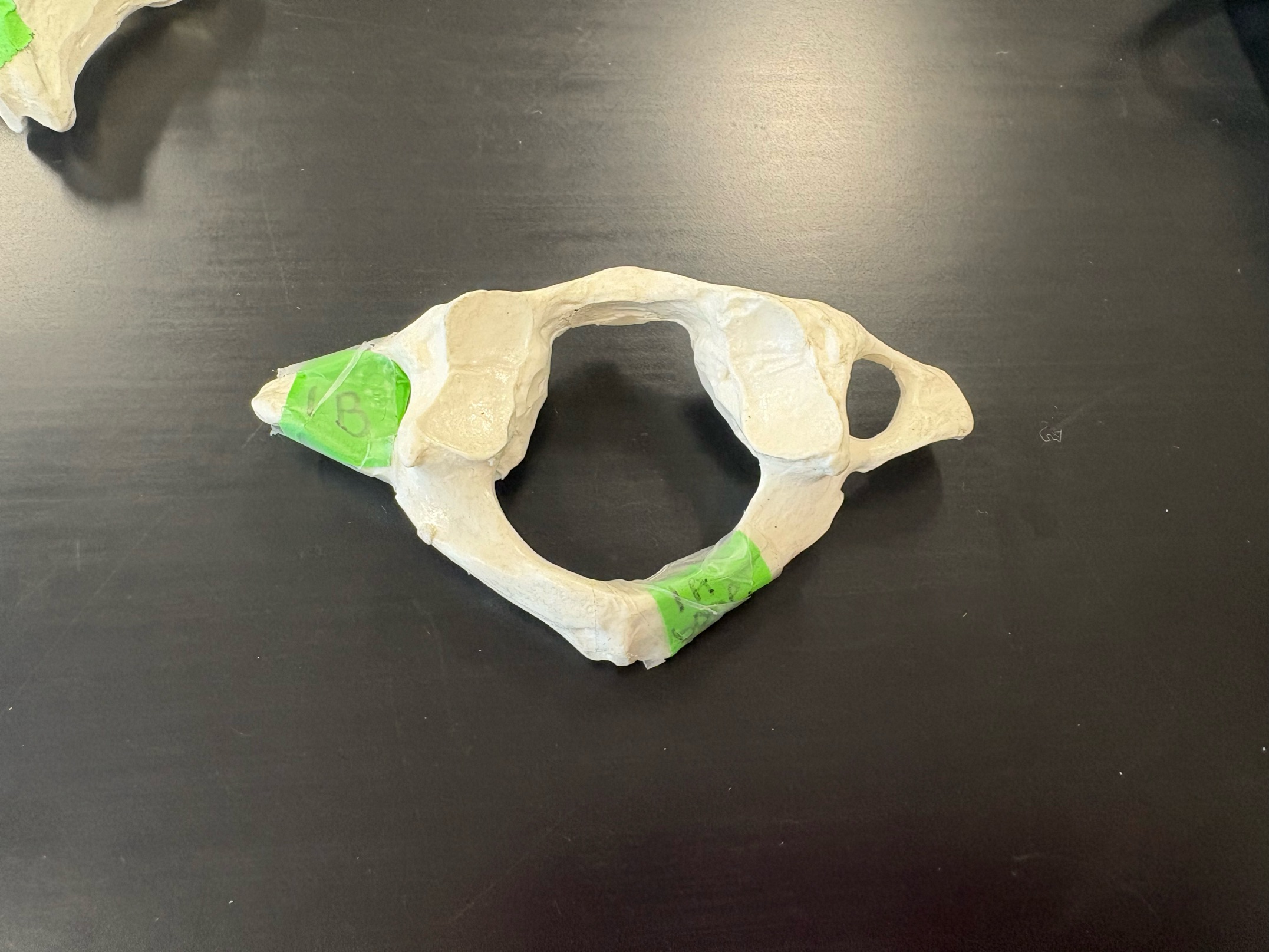 <p>Name this specific vertebra</p>