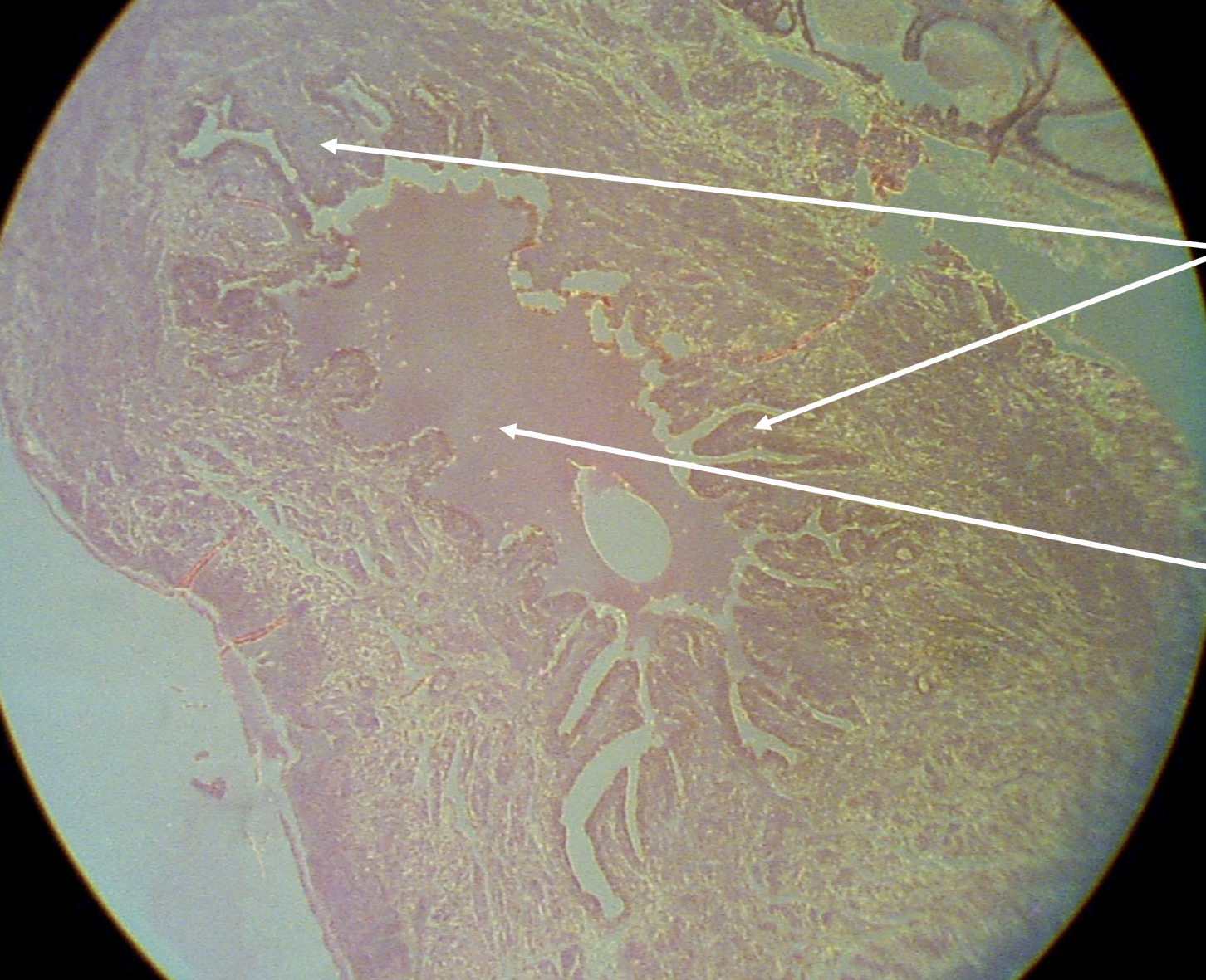 <p>What structure is depicted within the micrograph?</p>