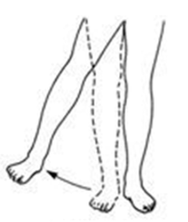 <p>What movement is this?</p>