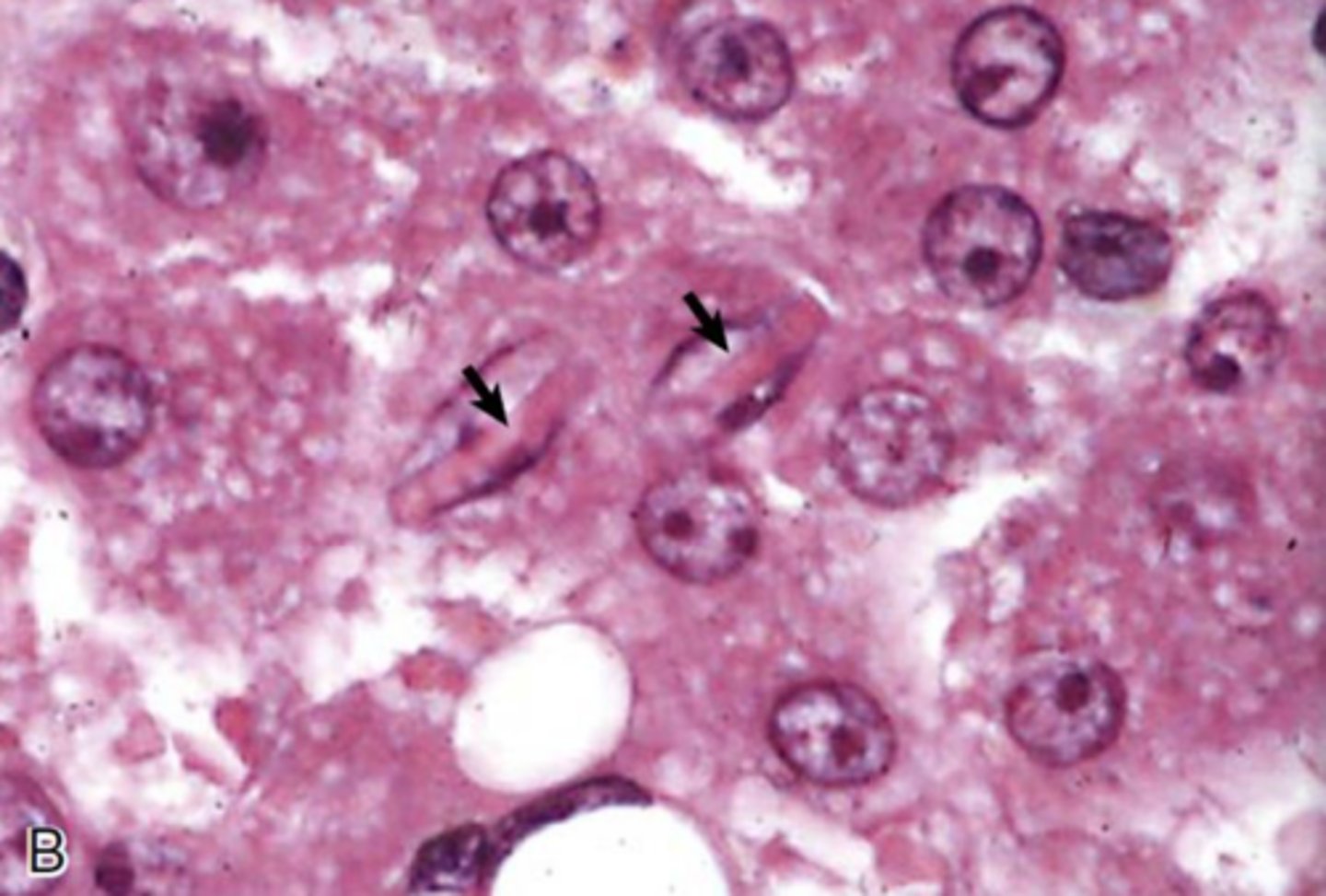 <p>What is the inclusion?</p>