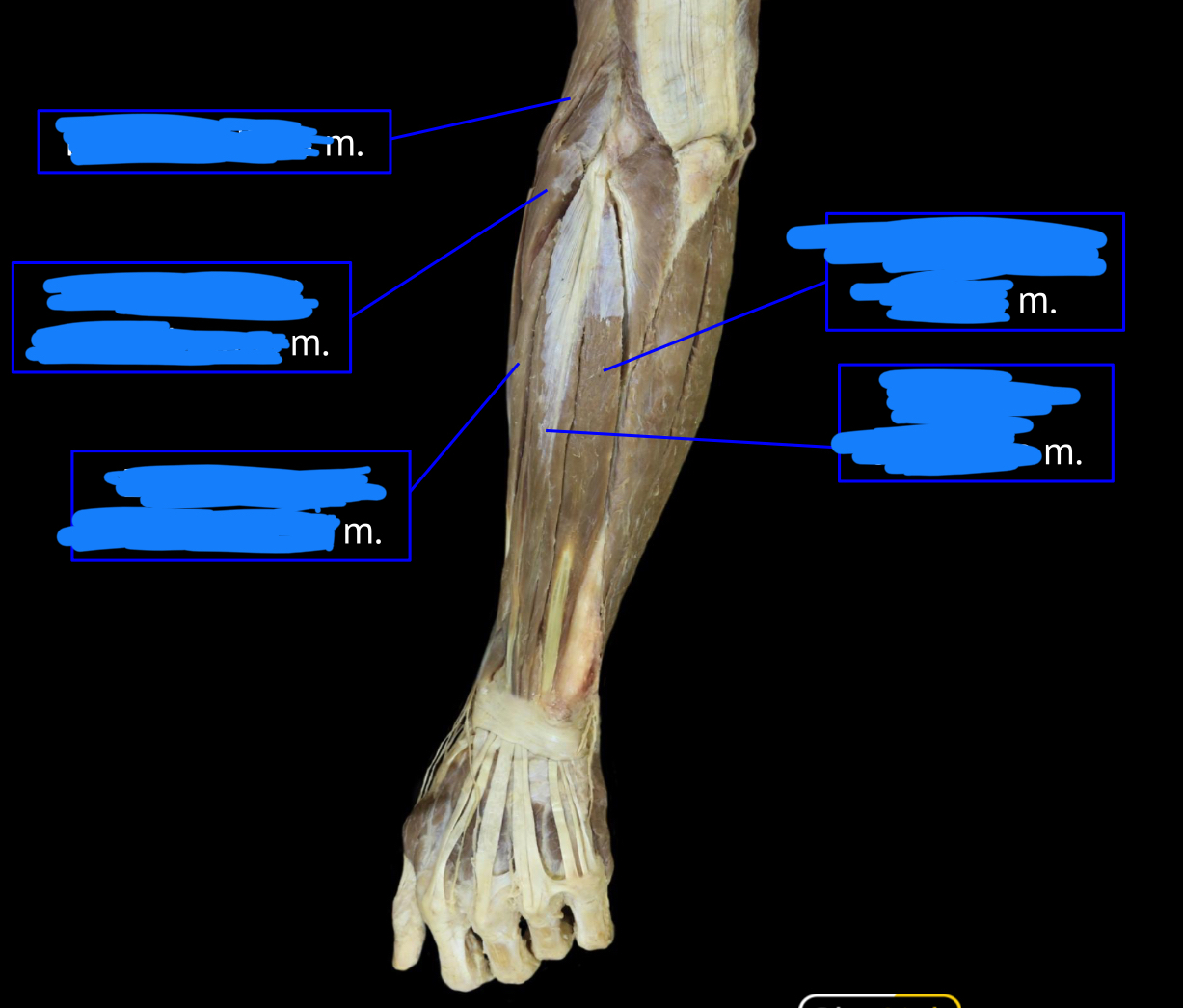 <p>top left muscle</p>