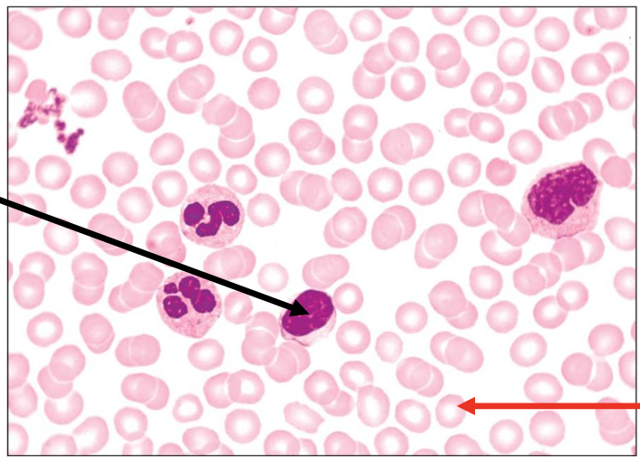 <p>The structure indicated by the red arrow contains </p><p></p><p>a. Nucleus</p><p>b. Nucleus and other organelles</p><p>c. Hemoglobin and nucleus</p><p>d. Hemoglobin</p>