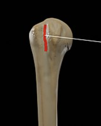 <p>What part of the humerus is this?</p>