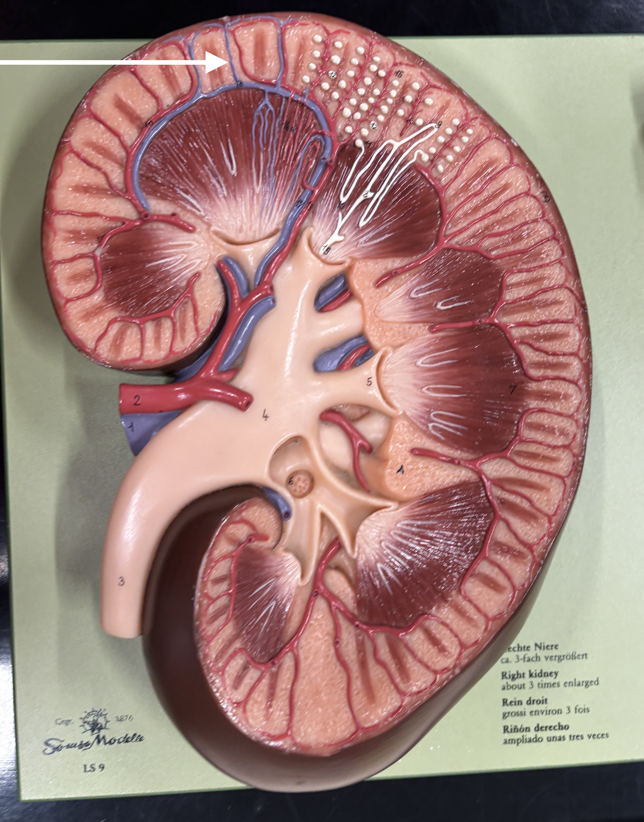 <p>what structure is the arrow pointing to? *vein*</p>