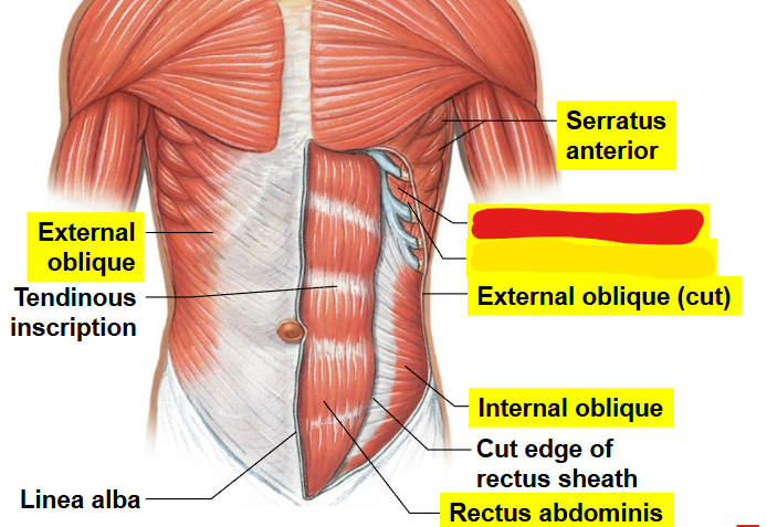 <p>What muscle is this?</p>