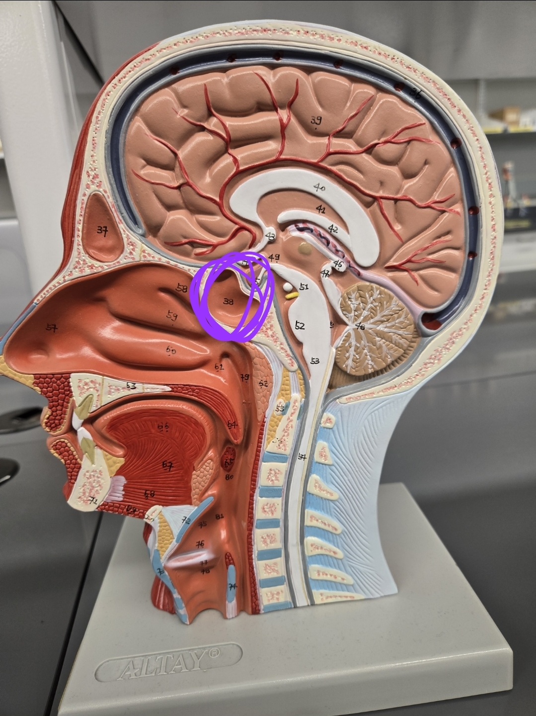 <p>Half head model: what structure is this?</p>