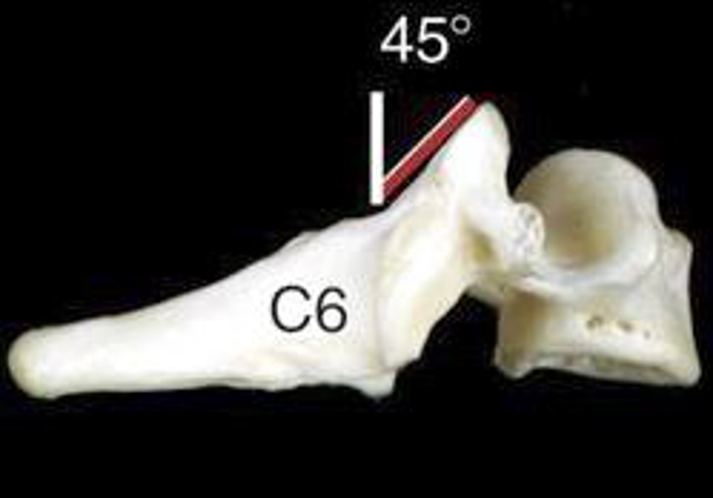 <p>45 degree angle to the transverse plane</p><p>*parallel to frontal plane</p><p>inferior facet of upper--&gt; faces inferior, anterior, slightly lateral</p><p>superior facet of lower--&gt; faces superior, posterior, and slightly medial</p>