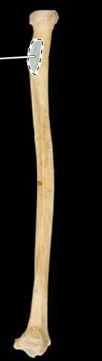 <p>Radius, medial view, right side</p>