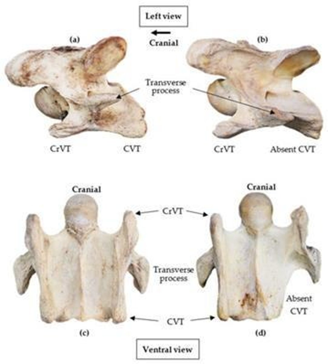 <p>Articulate with seventh cervical vertebra's transverse processes.</p>