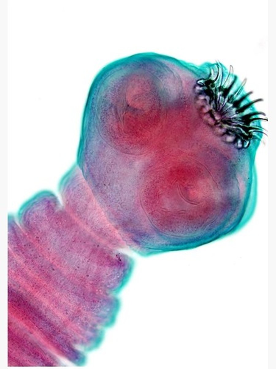 <p>Multicellular parasitic worms.</p>