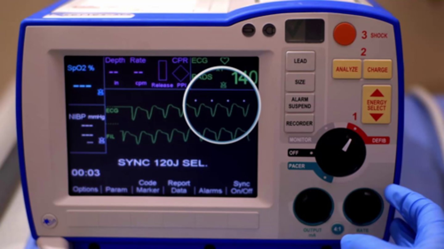 <p>Used for supraventricular dysrhythmias and VT w pulse</p><p>Usually small shock w less electricity bc pt is alive</p><p>Requires synchronization w cardiac cycle= must have PULSE</p>