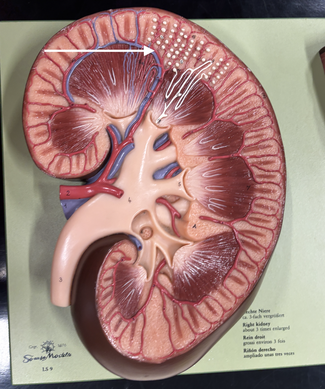<p>what structure is the arrow pointing to? *artery*</p>