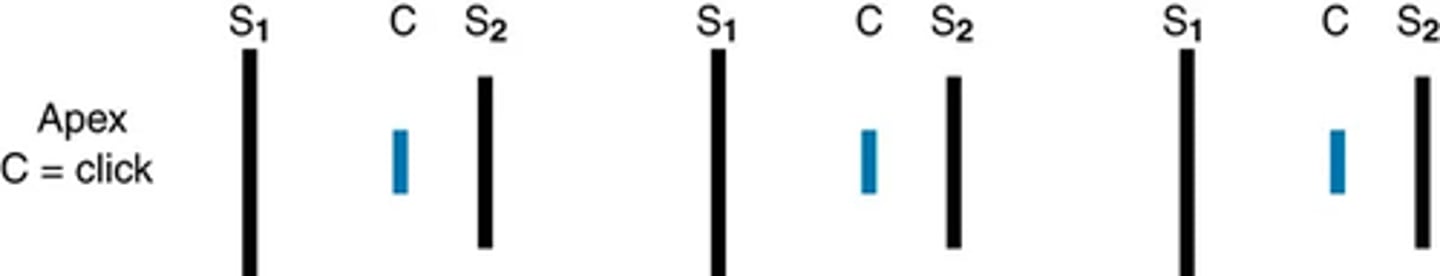 <p>As a sequela of modern technologic intervention for heart problems, some people now have iatrogenically induced heart sounds.</p><p>The opening of a mechanical aortic ball-in-cage prosthesis produces an early systolic sound. This sound is less intense with a tilting disk prosthesis and is absent with a bioprosthetic valve</p>