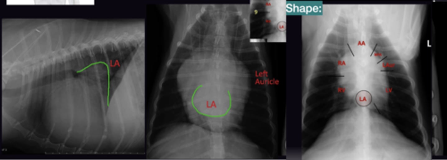 <p>1. Left Atrium, Left Auricle, main Pulmonary Artery (VD)</p><p>2. Radiography is not accurate for right side enlargement</p>