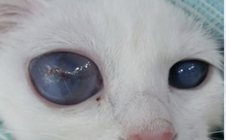 <p>What is the term for an enlarged globe from congenital glaucoma?</p>
