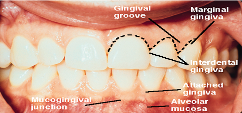 <p>Gingival margin </p>