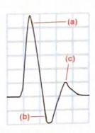 <p>Label the 3 phases of this triphasic waveform</p>